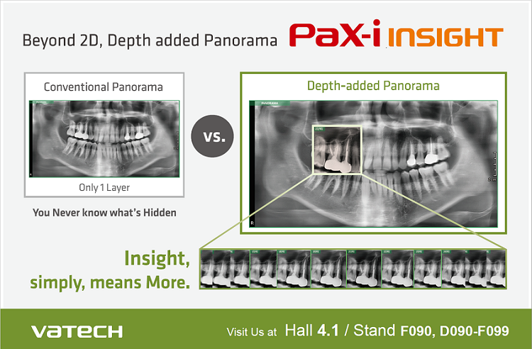 PaX-i Insight