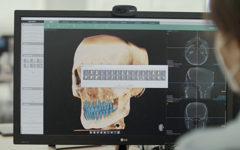 Vatech Reports Highest Ever Q1 Fiscal Results
