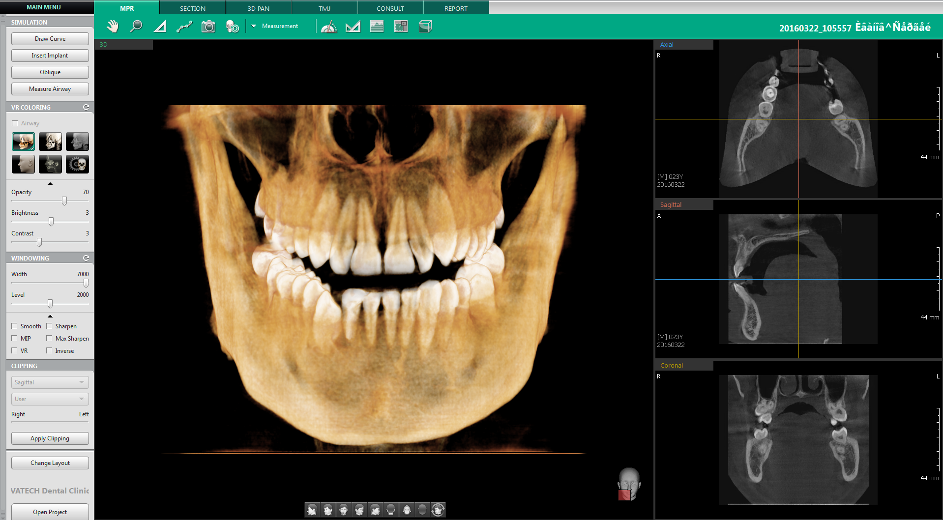 ez3d-i simple viewer download