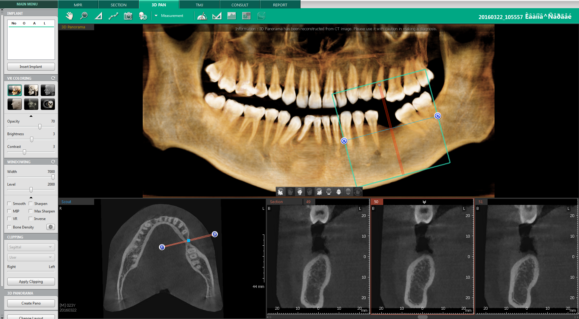 ez3d-i simple viewer download